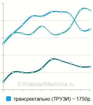 Средняя стоимость УЗИ предстательной железы в Калуге